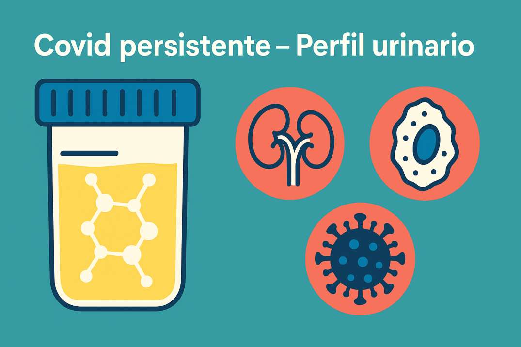 análisis de orina revela una “firma molecular” de la covid persistente: colágeno, endotelio y coagulación