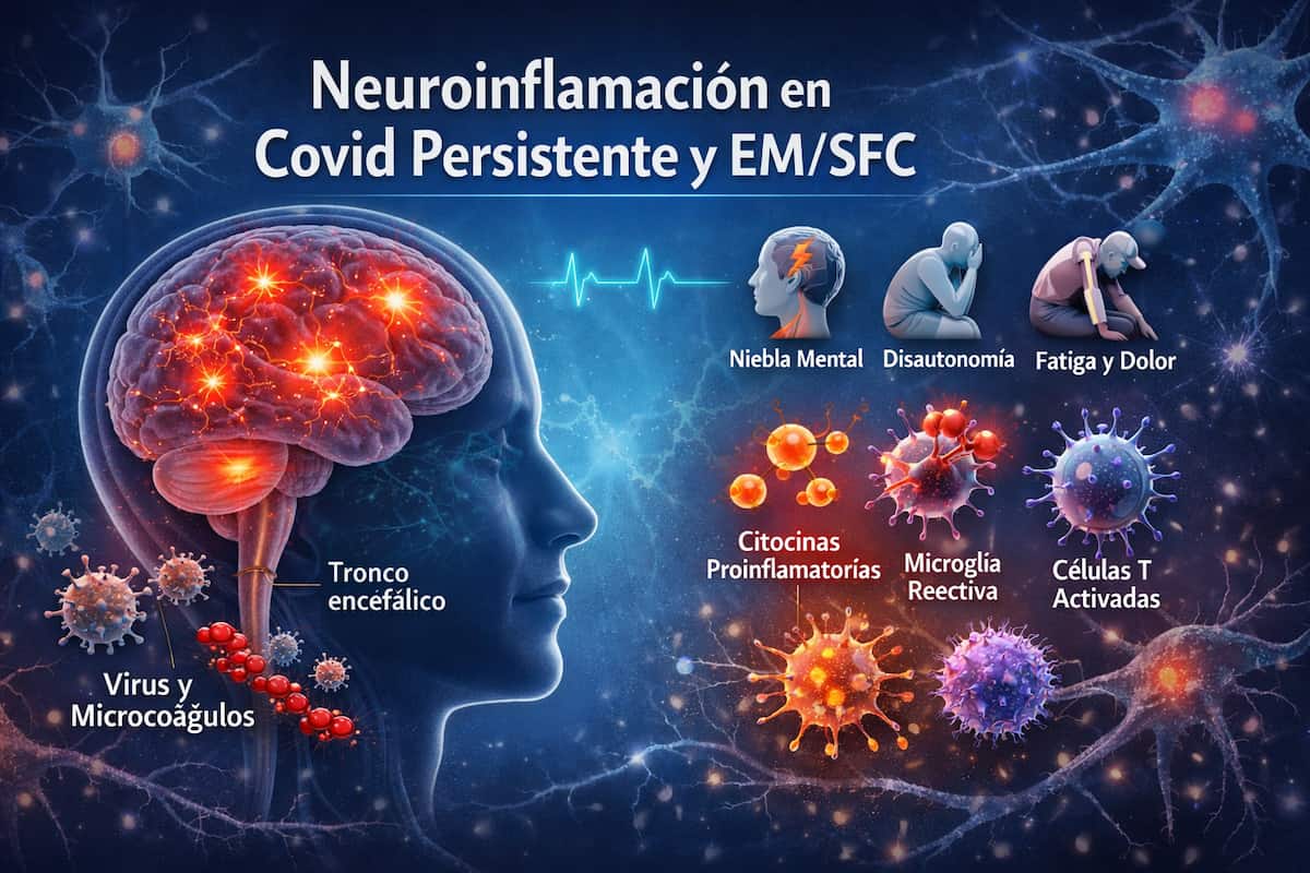 Neuroinflamación en covid persistente y EM/SFC