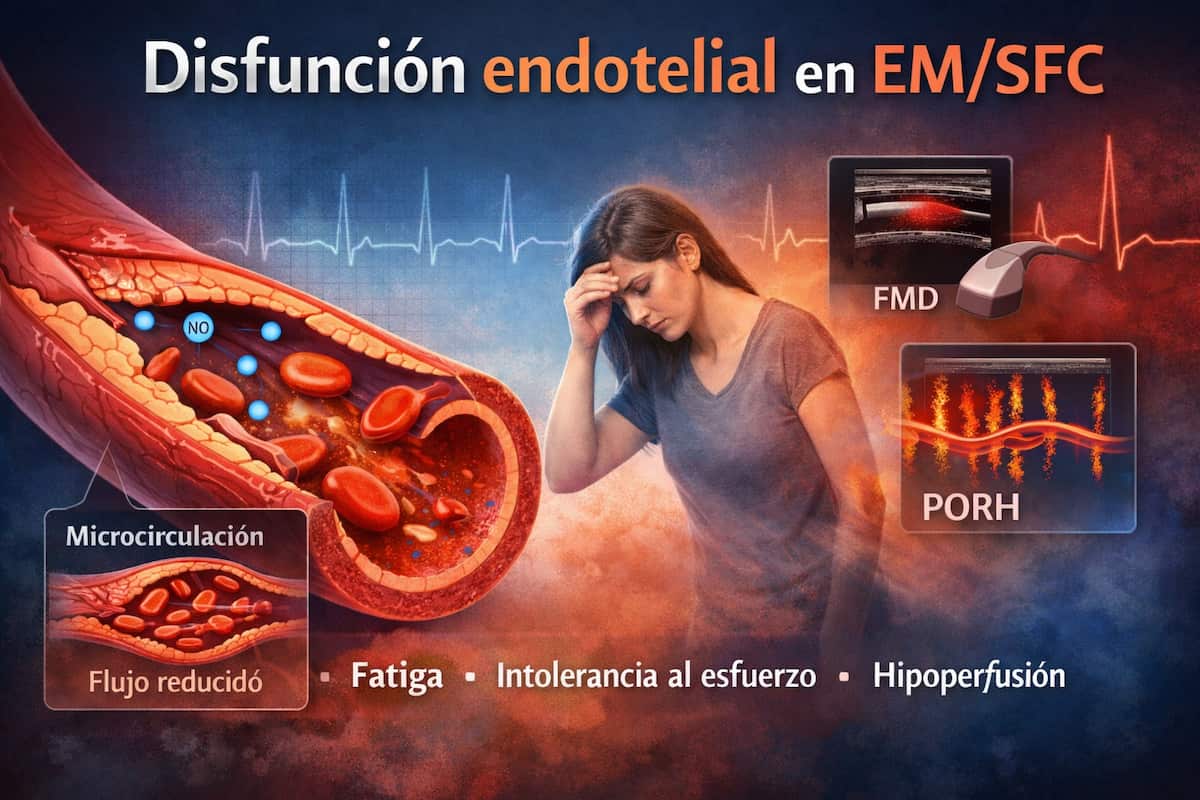 Disfunción endotelial en EM/SFC: evidencia objetiva en grandes vasos y microcirculación