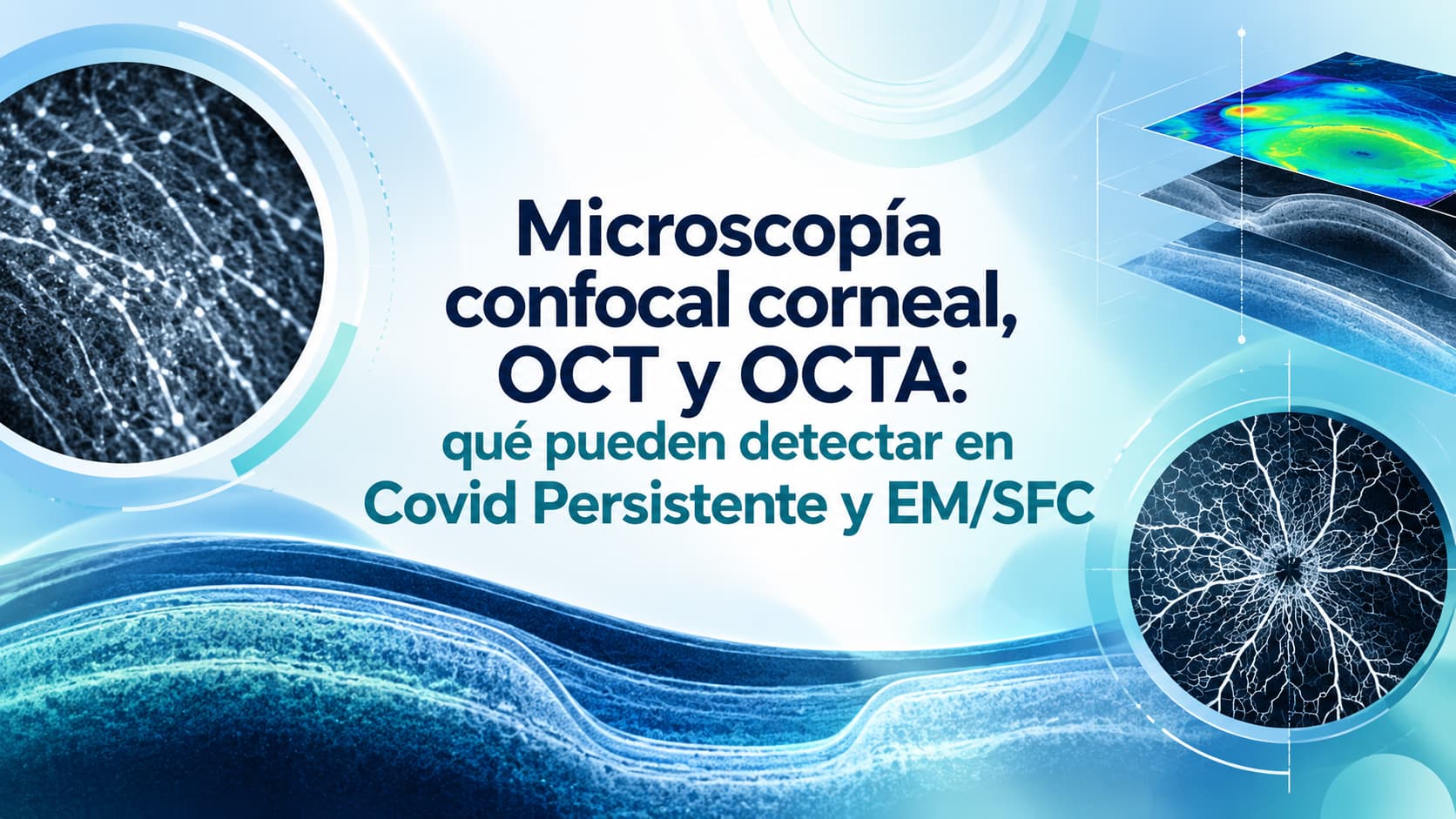 Microscopía confocal corneal, OCT y OCTA: qué pueden detectar en Covid Persistente y EM/SFC